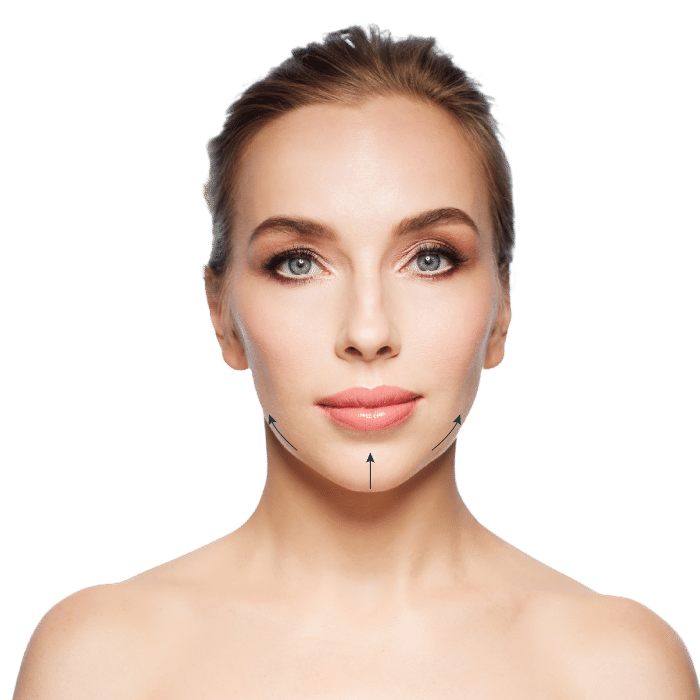 Jawline Filler and Chin Contour